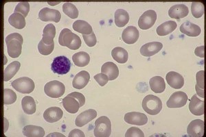 Lymphocyte, platelet fragment, megathrombocyte, M-7 leukemia